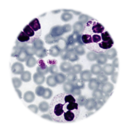 Anaplasma phagocytophilum, qPCR - Equigerminal