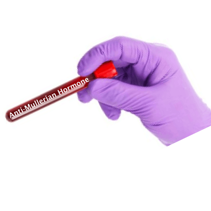 Anti-Müllerian Hormone (AMH) - Equigerminal