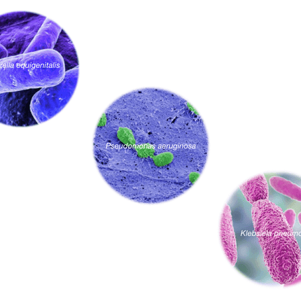 Contagious Equine Metritis (CEM), qPCR - Equigerminal