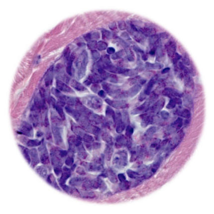 Equine Protozoa Myeloencephalitis, qPCR - Equigerminal