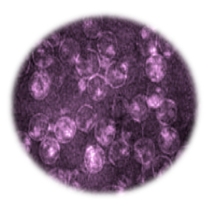 Equine Encephalosis Virus, RT-qPCR - Equigerminal