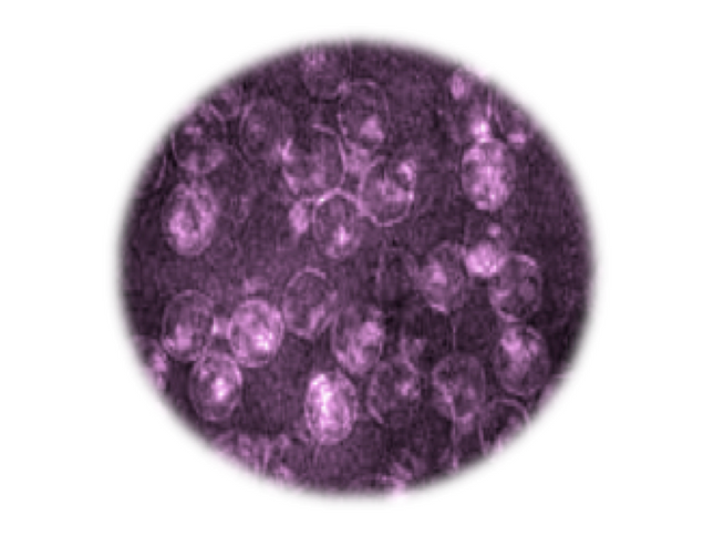 Equine Encephalosis Virus, RT-qPCR - Equigerminal