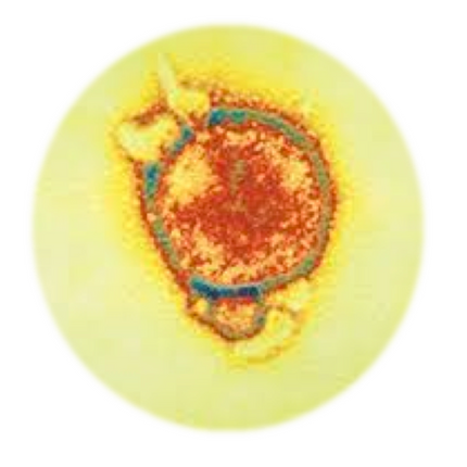 Hendra virus, RT-qPCR - Equigerminal