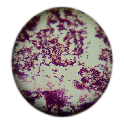 Rhodococcus equi, qPCR - Equigerminal
