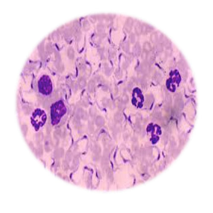 Dourine - Trypanosoma equiperdum, qPCR - Equigerminal